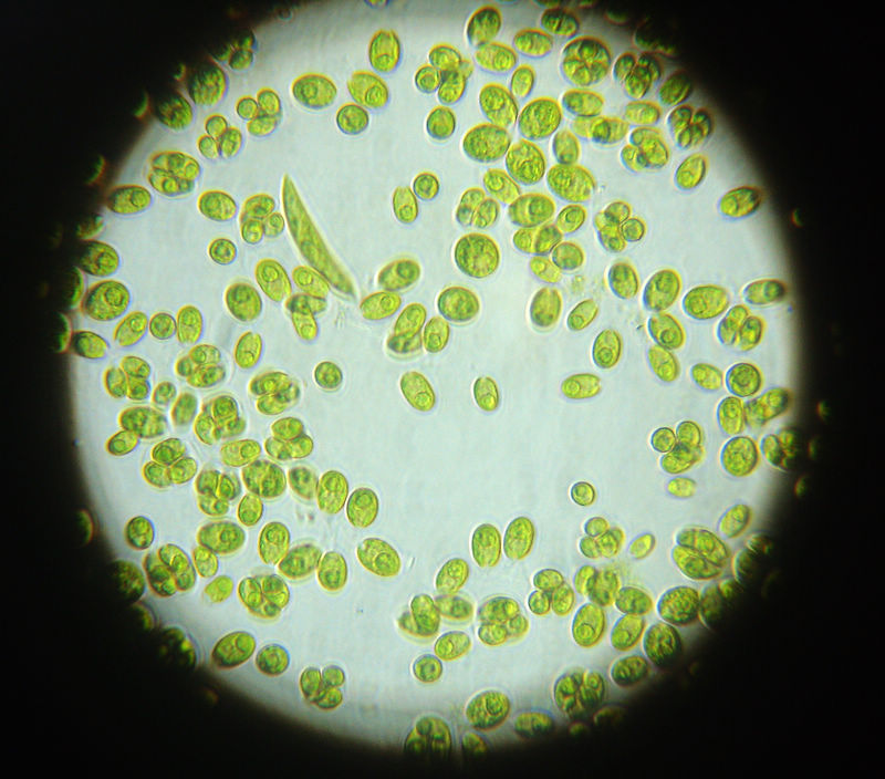 绿藻显微镜下的图片图片